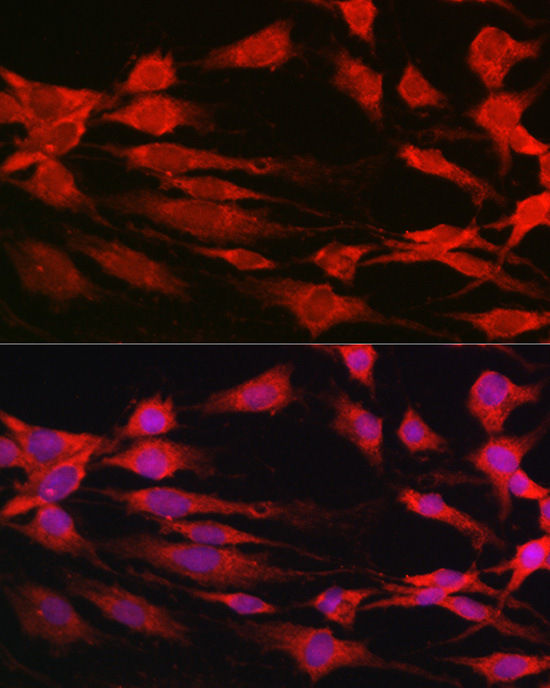 Rabbit anti-RPS6KB1 Polyclonal Antibody