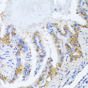 Rabbit anti-NAT2 Polyclonal Antibody