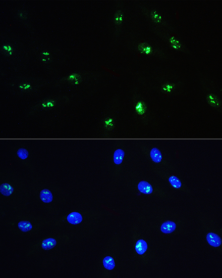 Rabbit anti-NOP58 Polyclonal Antibody