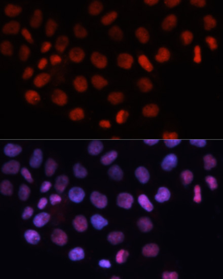 Rabbit anti-RCC1 Polyclonal Antibody
