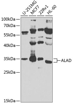 Rabbit anti-ALAD Polyclonal Antibody