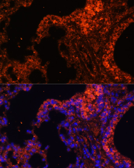 Rabbit anti-SPTA1 Polyclonal Antibody