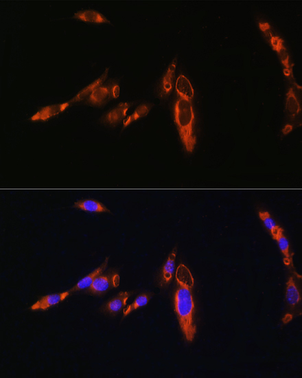 Rabbit anti-AVPR1A Polyclonal Antibody