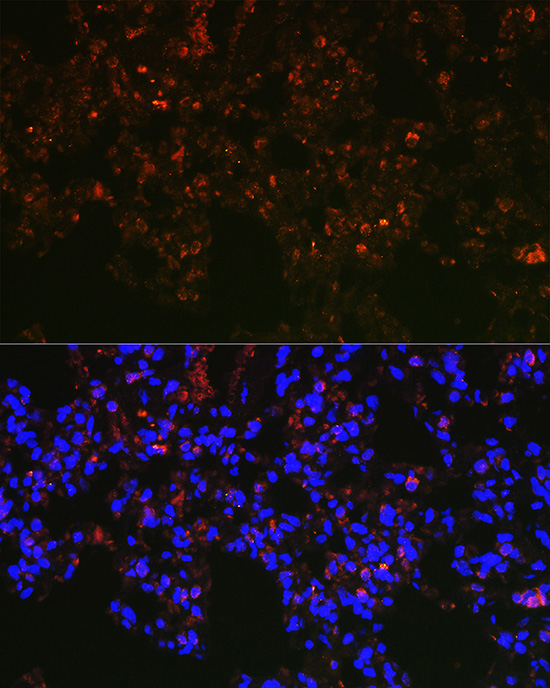 Rabbit anti-NAPSA Polyclonal Antibody