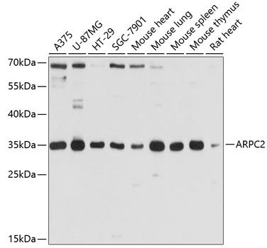 Rabbit anti-ARPC2 Polyclonal Antibody