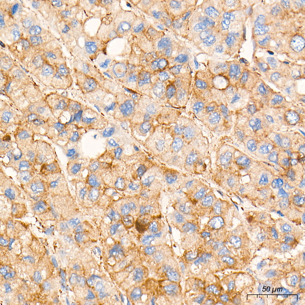 Rabbit anti-AGTRAP Polyclonal Antibody