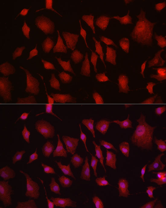 Rabbit anti-HK3 Polyclonal Antibody