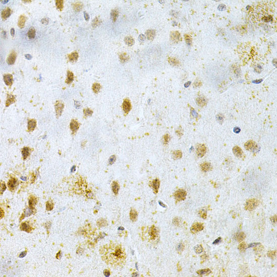 Rabbit anti-MAP2 Polyclonal Antibody