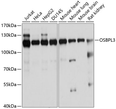 Rabbit anti-OSBPL3 Polyclonal Antibody