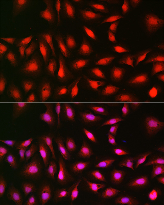 Rabbit anti-RPS6KB1 Polyclonal Antibody