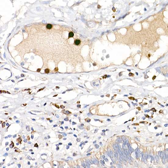 Rabbit anti-S100A12 Polyclonal Antibody