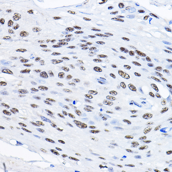 Rabbit anti-SMEK1 Polyclonal Antibody