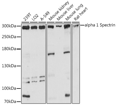 Rabbit anti-SPTA1 Polyclonal Antibody