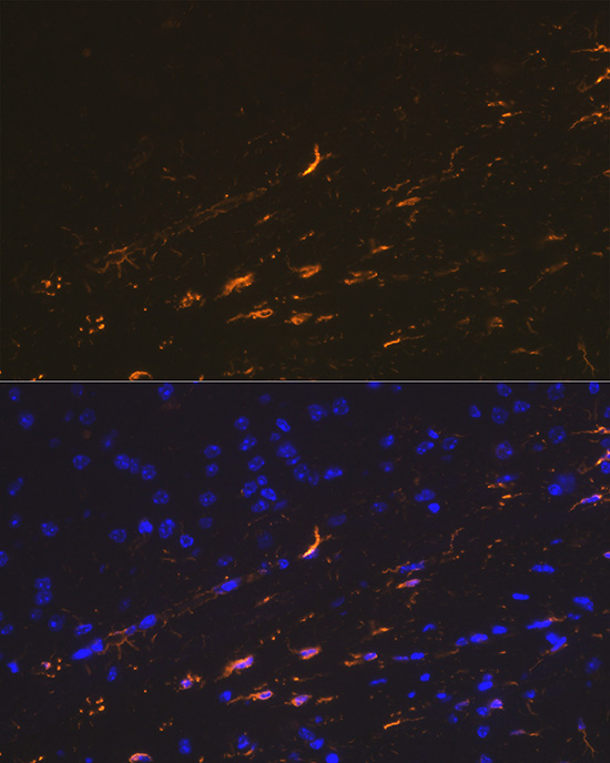 Rabbit anti-GFAP Polyclonal Antibody