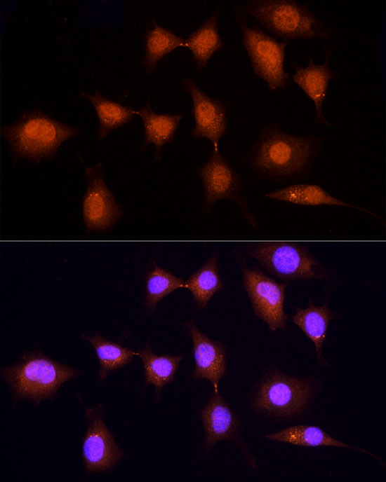 Rabbit anti-KPNA3 Polyclonal Antibody