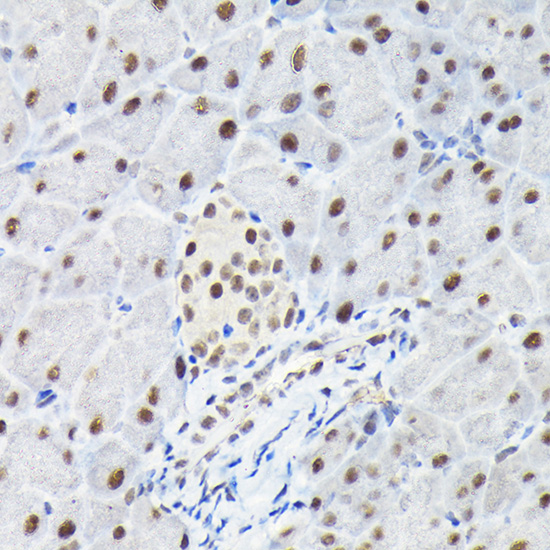 Rabbit anti-KPNA3 Polyclonal Antibody