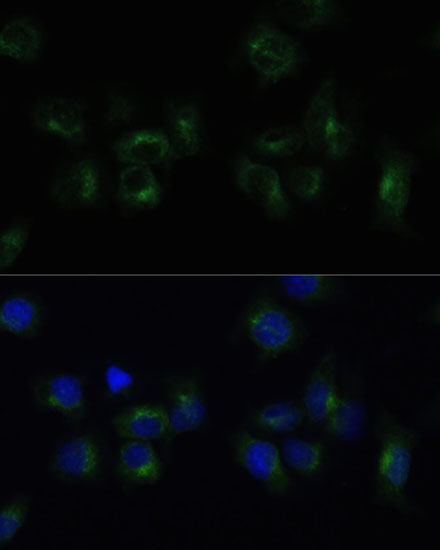 Rabbit anti-CLTB Polyclonal Antibody