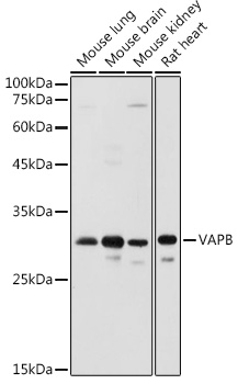 Rabbit anti-VAPB Polyclonal Antibody