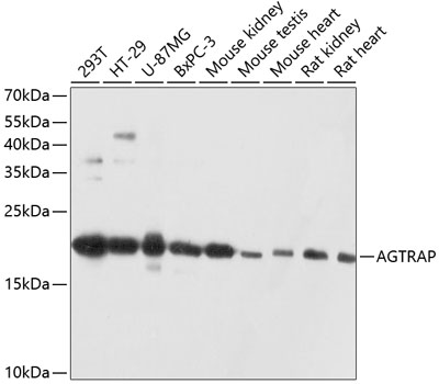 Rabbit anti-AGTRAP Polyclonal Antibody