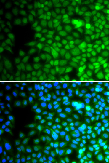 Rabbit anti-ZNF195 Polyclonal Antibody