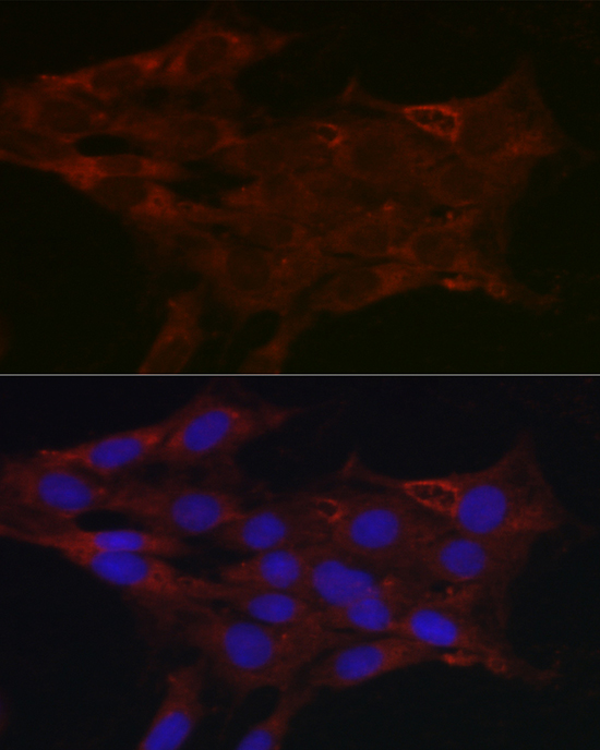 Rabbit anti-UGT1A1 Polyclonal Antibody