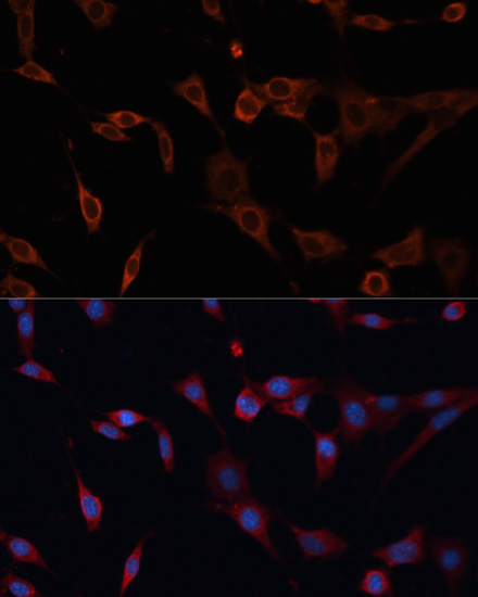 Rabbit anti-PDIA2 Polyclonal Antibody