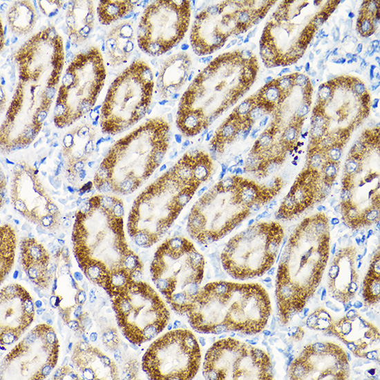 Rabbit anti-SCFD1 Polyclonal Antibody