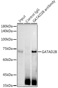 Rabbit anti-GATAD2B Polyclonal Antibody