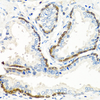 Rabbit anti-BMP5 Polyclonal Antibody