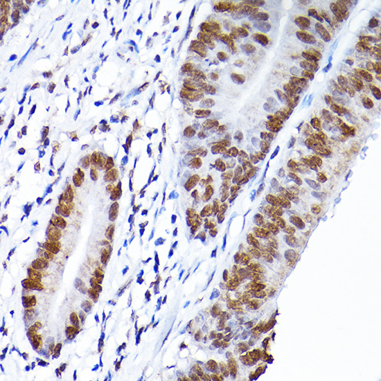 Rabbit anti-RCC1 Polyclonal Antibody
