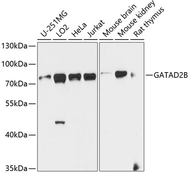 Rabbit anti-GATAD2B Polyclonal Antibody