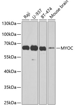 Rabbit anti-MYOC Polyclonal Antibody