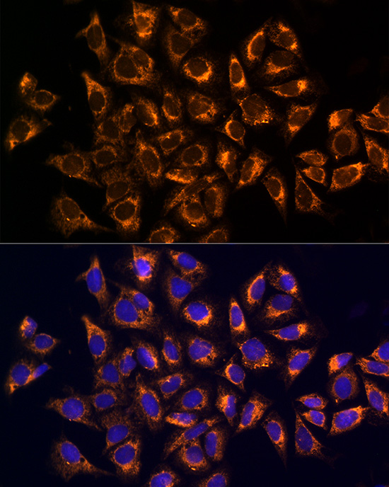 Rabbit anti-CKAP4 Polyclonal Antibody