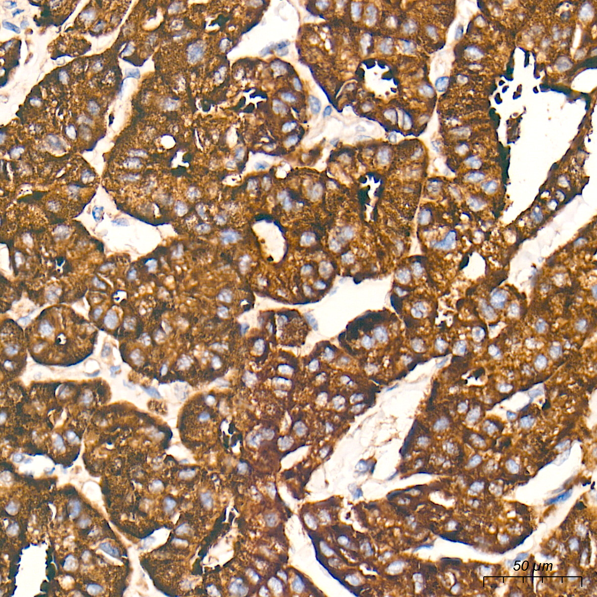 Rabbit anti-AGTRAP Polyclonal Antibody