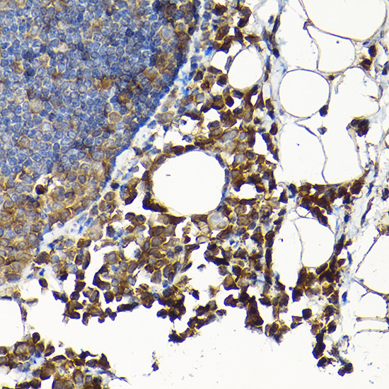 Rabbit anti-SCFD1 Polyclonal Antibody