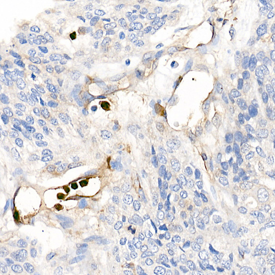 Rabbit anti-S100A12 Polyclonal Antibody