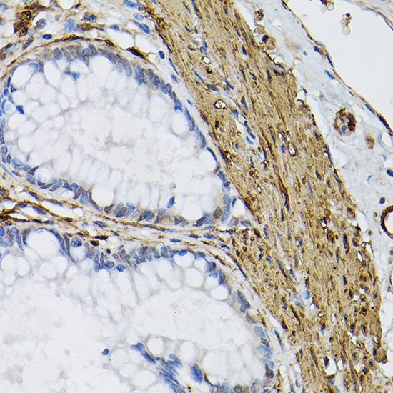 Rabbit anti-TGM2 Polyclonal Antibody