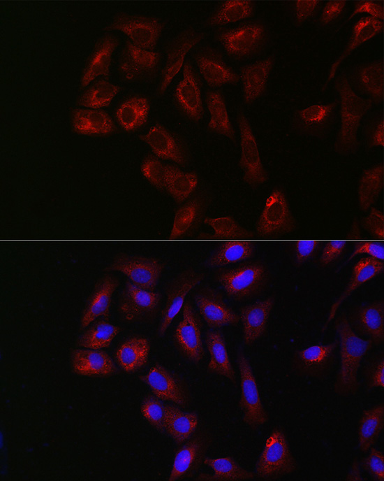 Rabbit anti-YES1 Polyclonal Antibody