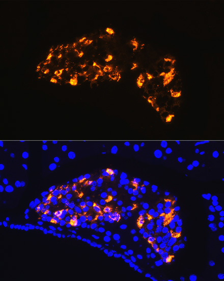Rabbit anti-SST Polyclonal Antibody