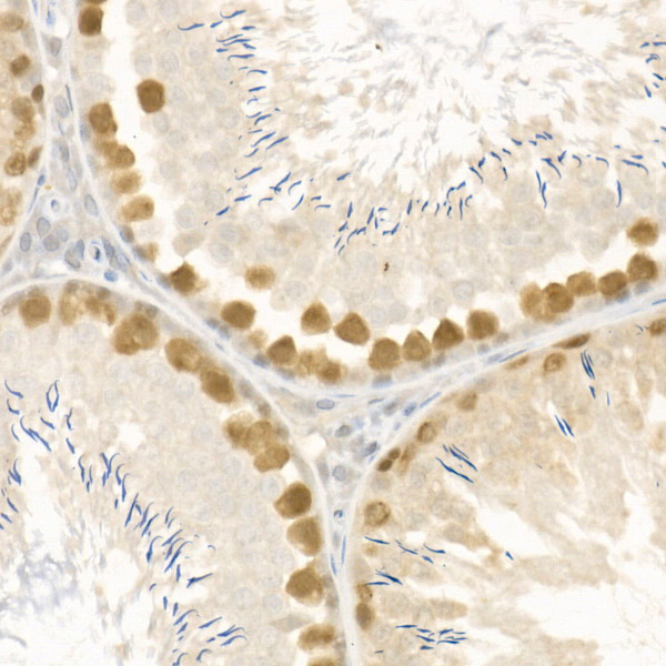 Rabbit anti-RAD51 Polyclonal Antibody