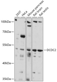 Rabbit anti-DCDC2 Polyclonal Antibody