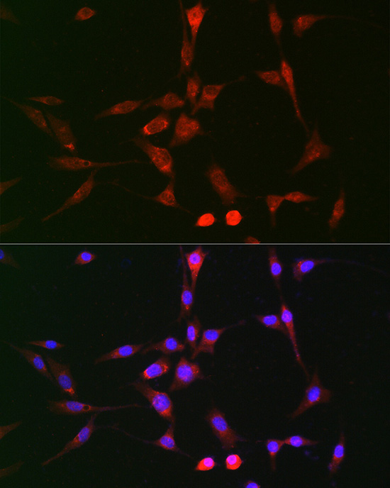 Rabbit anti-LOX Polyclonal Antibody