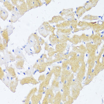 Rabbit anti-NAT2 Polyclonal Antibody