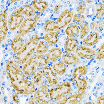 Rabbit anti-EEA1 Polyclonal Antibody