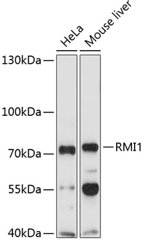 Rabbit anti-RMI1 Polyclonal Antibody