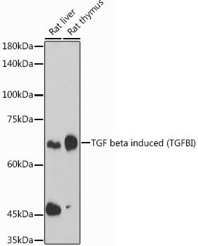 Rabbit anti-TGFBI Polyclonal Antibody