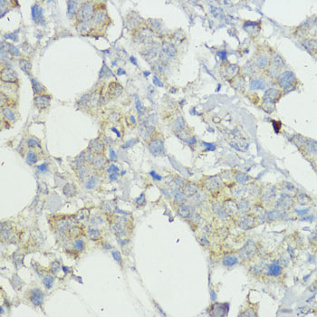 Rabbit anti-SOCS6 Polyclonal Antibody