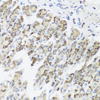 Rabbit anti-TIMM10B Polyclonal Antibody