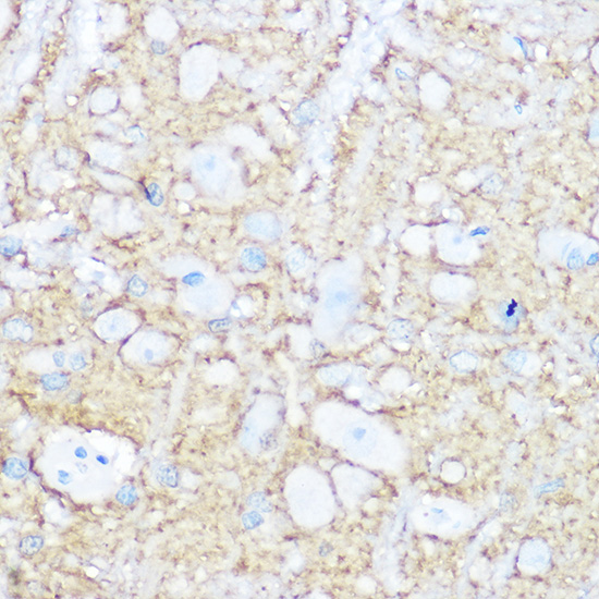 Rabbit anti-NCAM1 Polyclonal Antibody