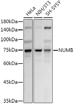 Rabbit anti-NUMB Polyclonal Antibody